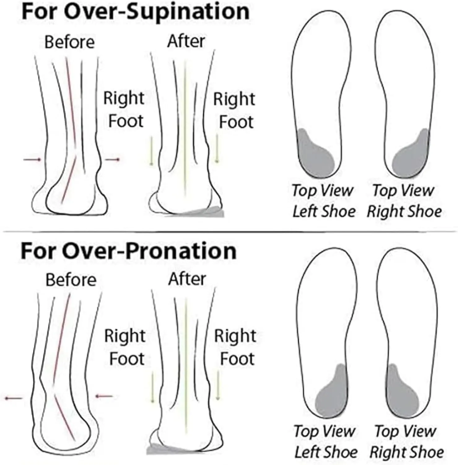Women's Soft Sole Mesh Comfort Orthopedic Shoes, Women's Casual Slip-On Flat Lightweight Soft Sole Mesh Comfort Orthopedic Shoes